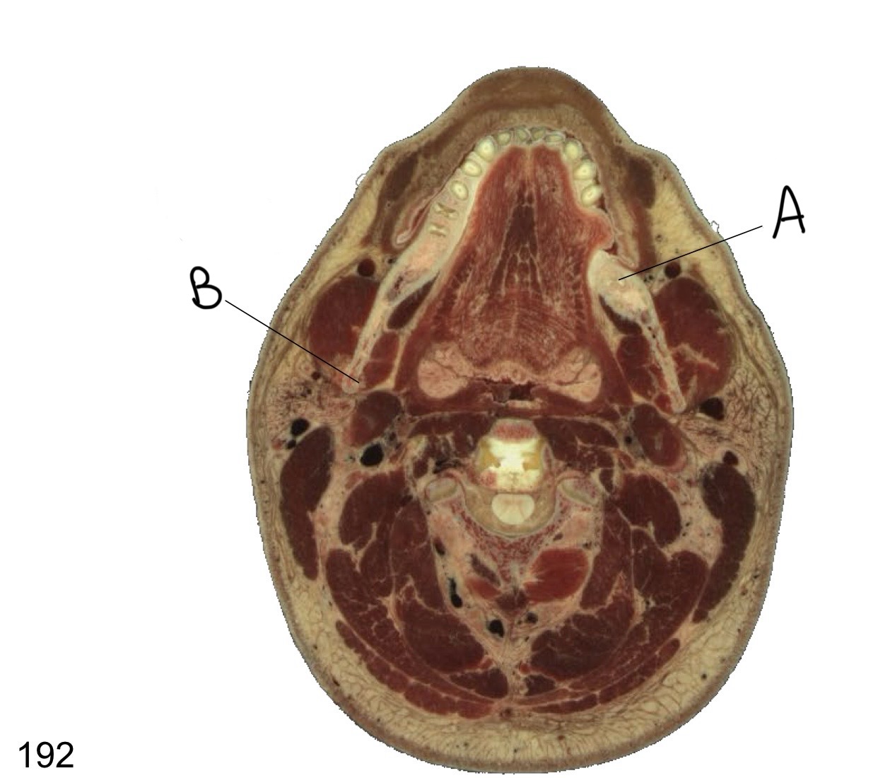 <p>What structure is labeled A?</p>