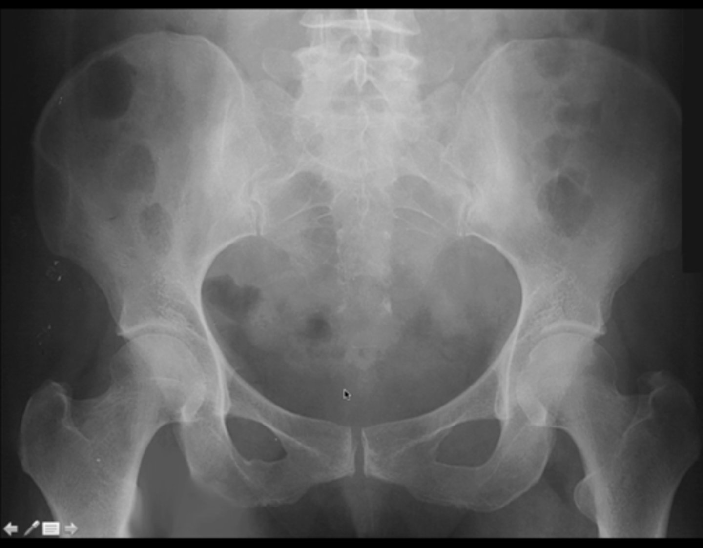 <p>What sex is this patient? How do you know?</p>
