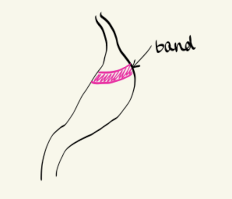 <p>invasive, sustainable</p>