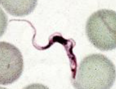 <ul><li><p>Sleeping sickness</p></li><li><p>Transmitted by tsetse flies</p></li><li><p>Acute form: East and Southern Africa</p><ul><li><p><span style="font-size: calc(var(--scale-factor)*20.27px)">rhodesiense HAT</span></p><ul><li><p>FAST</p></li><li><p>incubation is less than 3 weeks</p></li><li><p>rapidly progressive</p></li></ul></li></ul></li><li><p>Chronic form: West and Central Africa</p><ul><li><p>gambiense HAT</p><ul><li><p>SLOW</p></li><li><p>incubation is months</p></li><li><p>slowly progressive</p></li></ul></li></ul></li></ul><p></p>