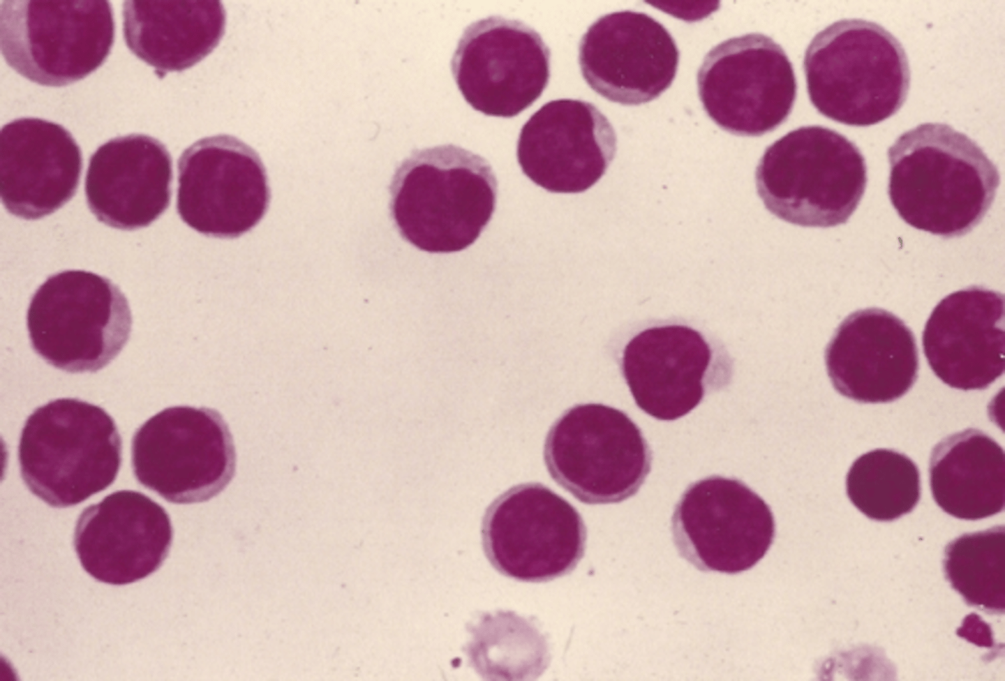 <p>Identify the cells in this body fluid</p>