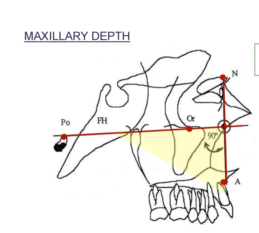 <p>Angle between <strong>Frankfort plane</strong> and <strong>Na-a line</strong></p><p class="has-focus"></p><p class="has-focus is-empty">Maxilla anteroposterior position</p><p class="has-focus"><strong>Higher - Maxillar protrusion</strong></p><p class="has-focus"><strong>Lower - Maxillar retrusion</strong></p>
