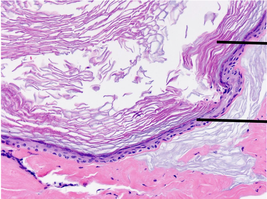 <p>Lable top to bottom and diagnose</p>