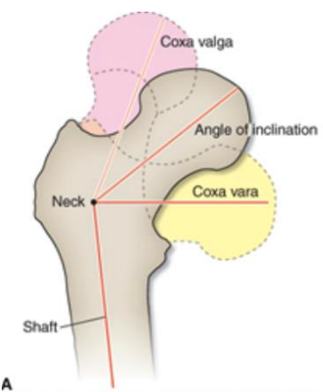 <p>-angle between the femoral neck and femoral shaft in the frontal plane</p><p>-adult normal ~125 degrees </p><p>-decreased angle = coxa vara <125 </p><p>-increased angle = coxa valga >125 degrees </p>