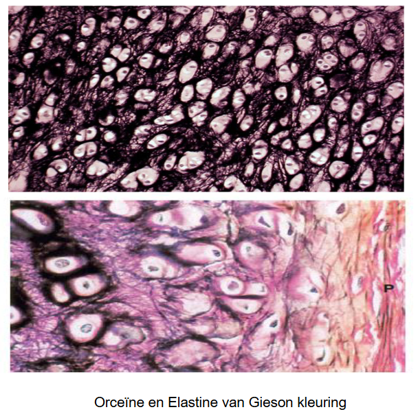 <ul><li><p>elastisch kraakbeen gevonden in:</p><ul><li><p>oorschelp</p></li><li><p>gedeelte van de wand van de buitenste gehoorgang</p></li><li><p>buis van Eustachius</p></li><li><p>epiglottis</p></li><li><p>sommige kraakbeenstukken van de larynx &amp; van bronchusvertakkingen</p></li></ul></li><li><p>elastisch kraakbeen gelijk aan hyalien kraakbeen, met 1 verschil:</p><ul><li><p>elastisch kraakbeen bezit naast collagene fibrillen ook een goed ontwikkeld netwerk van elastische vezels (&amp; is dus meer flexibel dan hyalien kraakbeen)</p></li></ul></li><li><p>perichondrium → ook veel elastische vezels</p></li><li><p>elastische vezels geven elastisch kraakbeen in verse toestand een gele tint</p></li><li><p>degeneratieve afwijkingen: minder frequent in elastisch kraakbeen</p></li></ul><p></p>