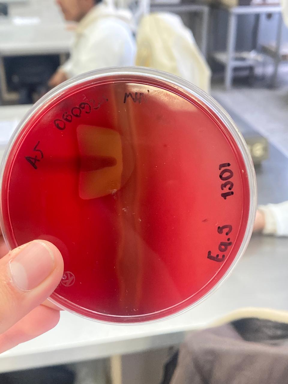 <p>De qué prueba se trata, y cuáles son los dos géneros bacterianos utilizados en esta</p>