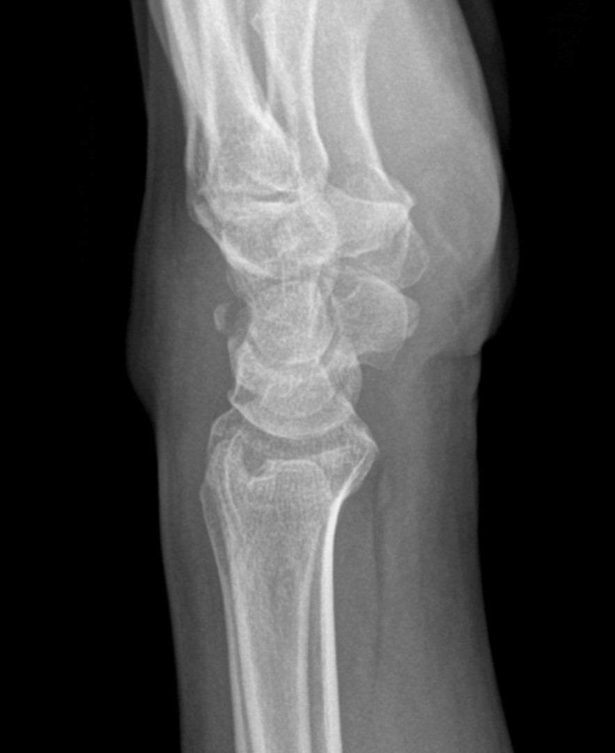 <p>Describe the abnormality demonstrated.</p>