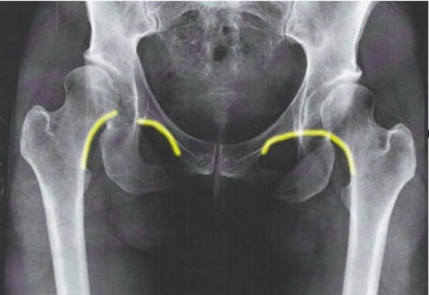 <p>What does this image indicate</p>