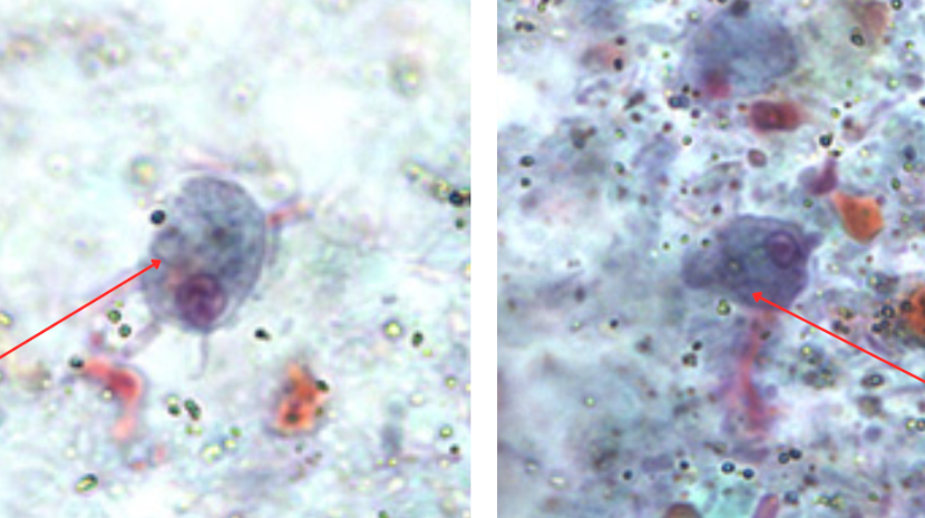 <p>Identify the organism. Give genus and species.</p>