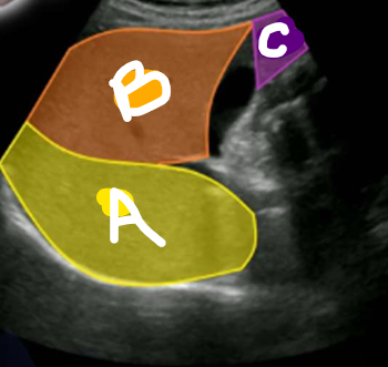 <p>A</p>