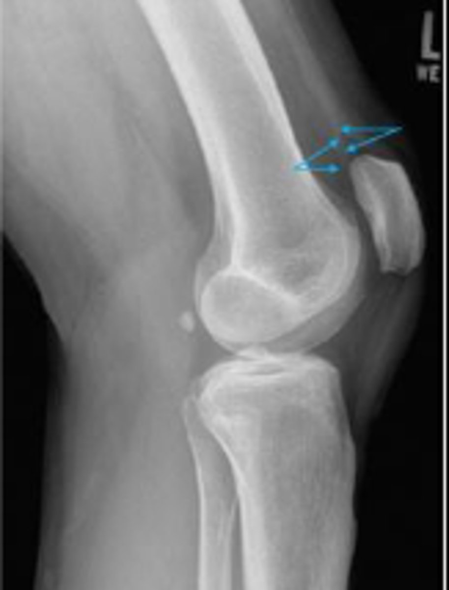 <p>What are the arrows pointing to?</p>