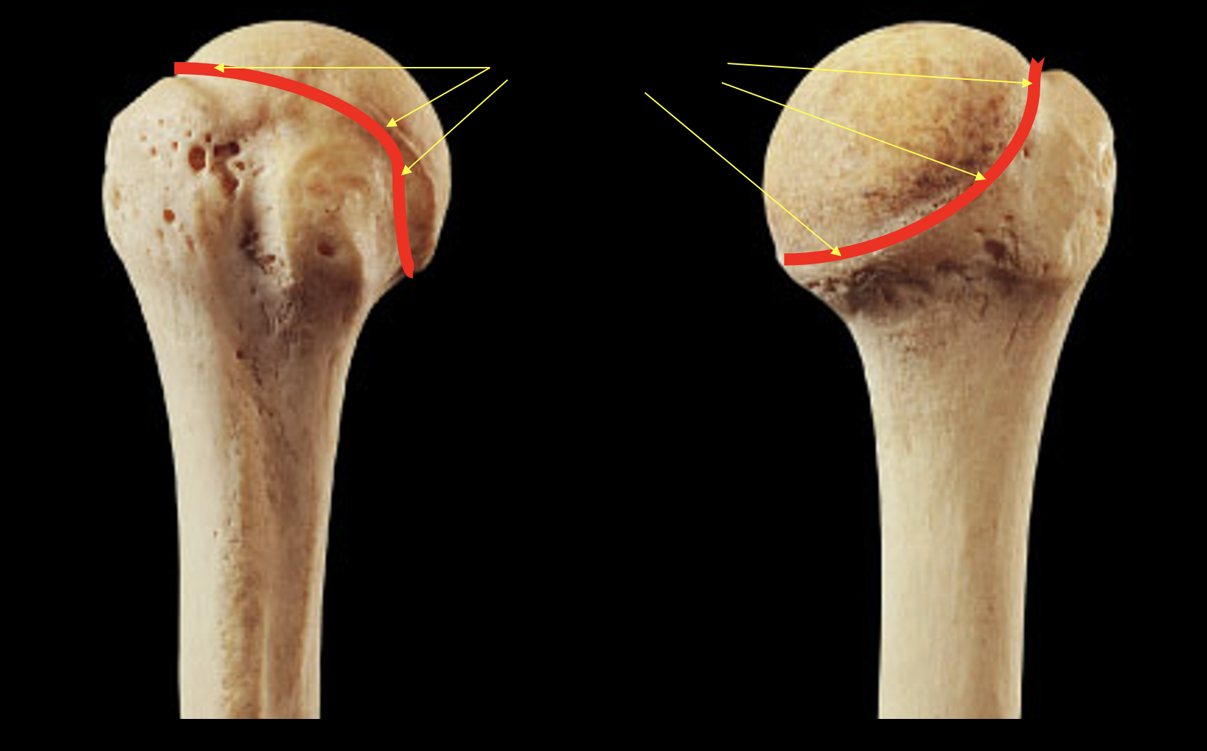 <p>Name this region of the humerus</p>