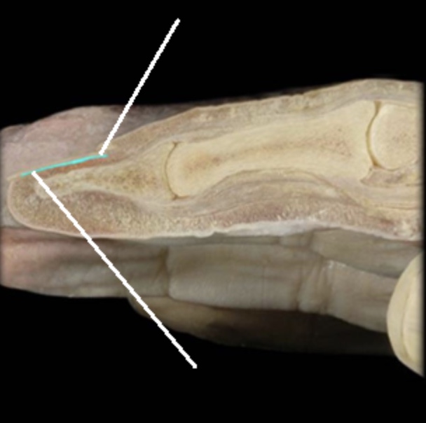 <p>Nail bed</p>