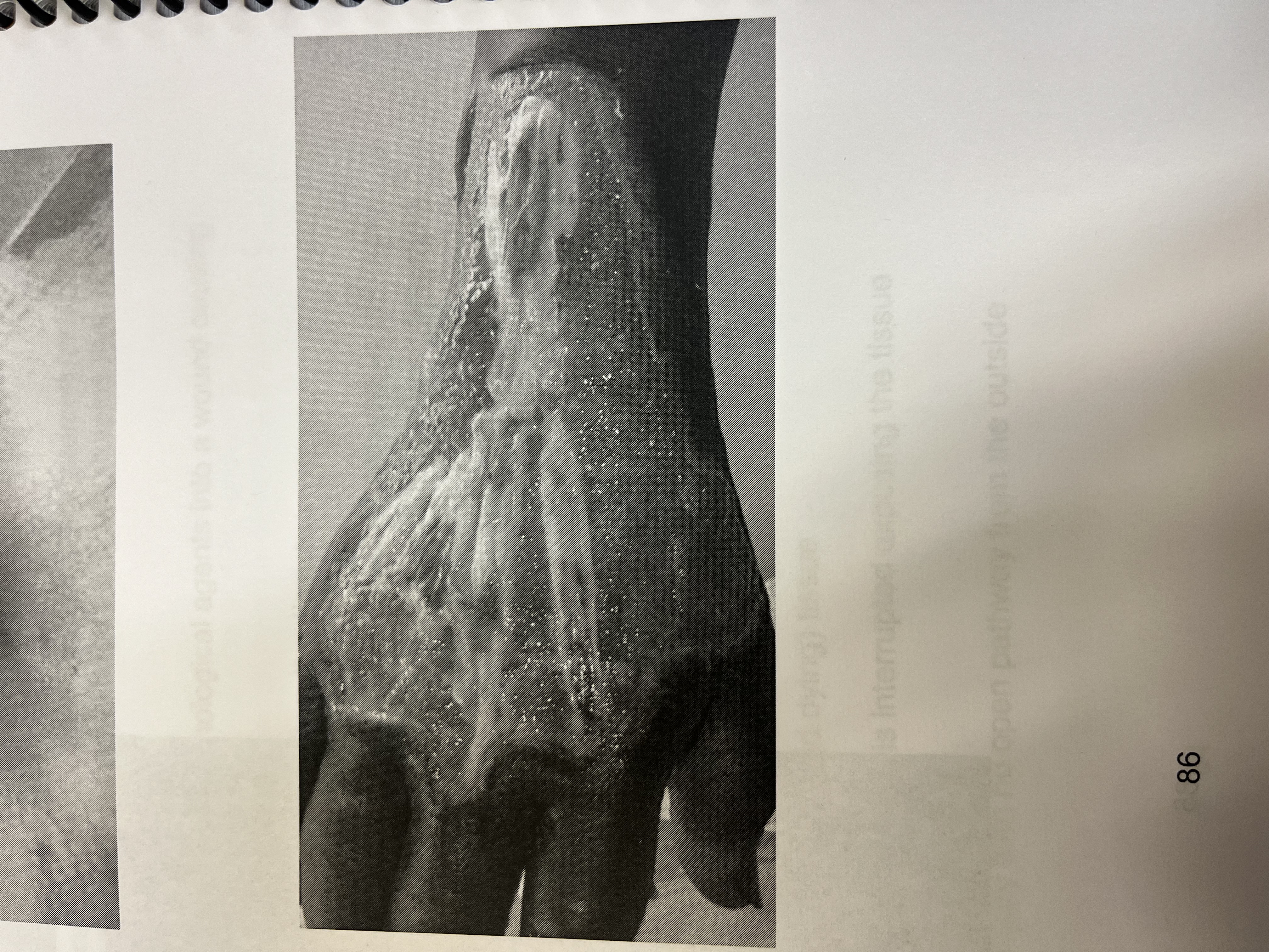 <p>injury to tissues caused by contact with thermal, chemical, electrical, radiation, light </p>