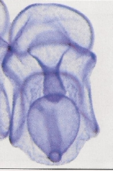 <p>the first stage in larva development of most starfish, followed by the brachiolaria stage</p><p>- bilateral symmetry</p>