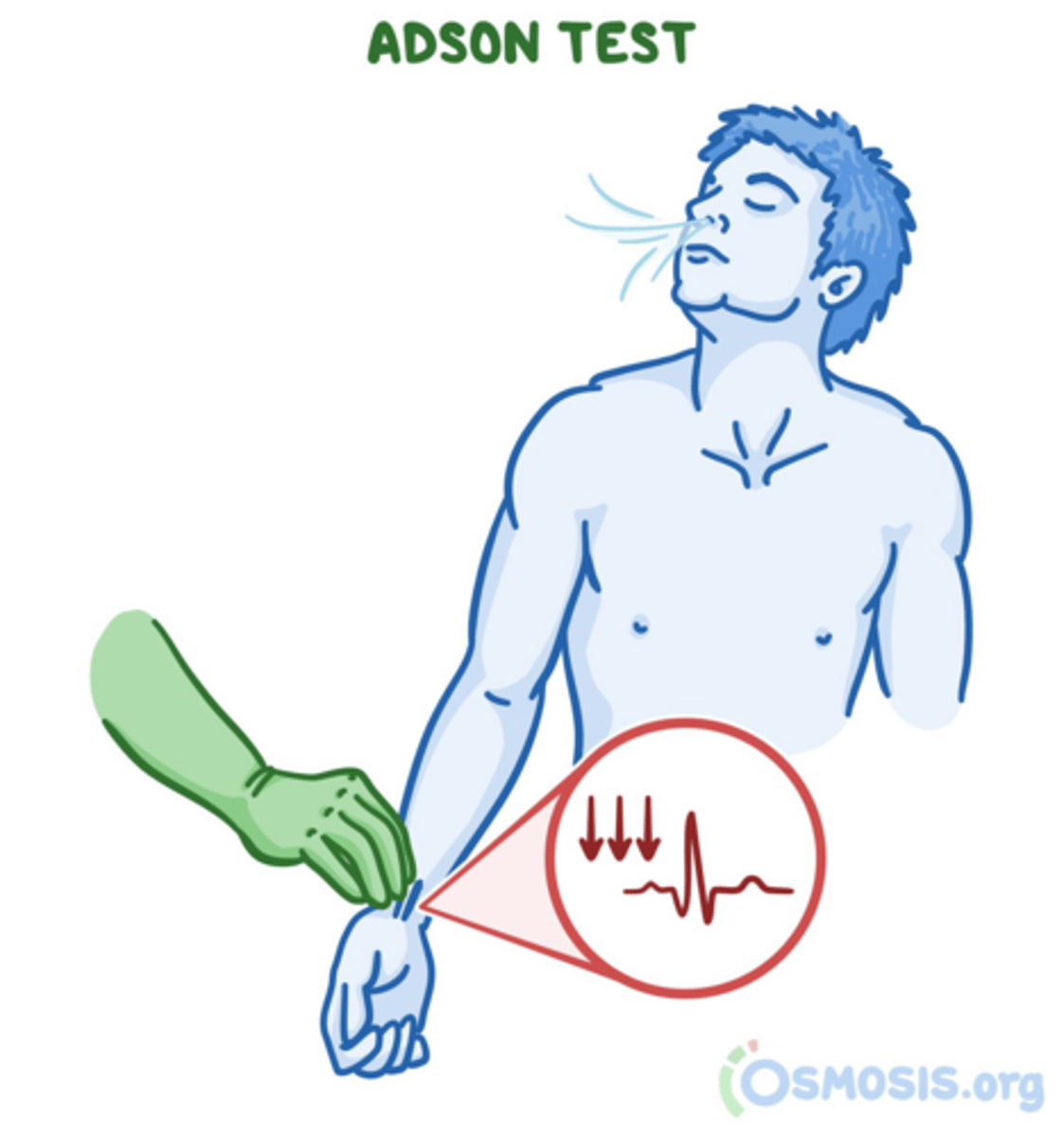 <p>examiner palpates radial pulse while extending/externally rotating the arm; patient then extends and rotates neck toward the test arm and takes a deep breath.</p>