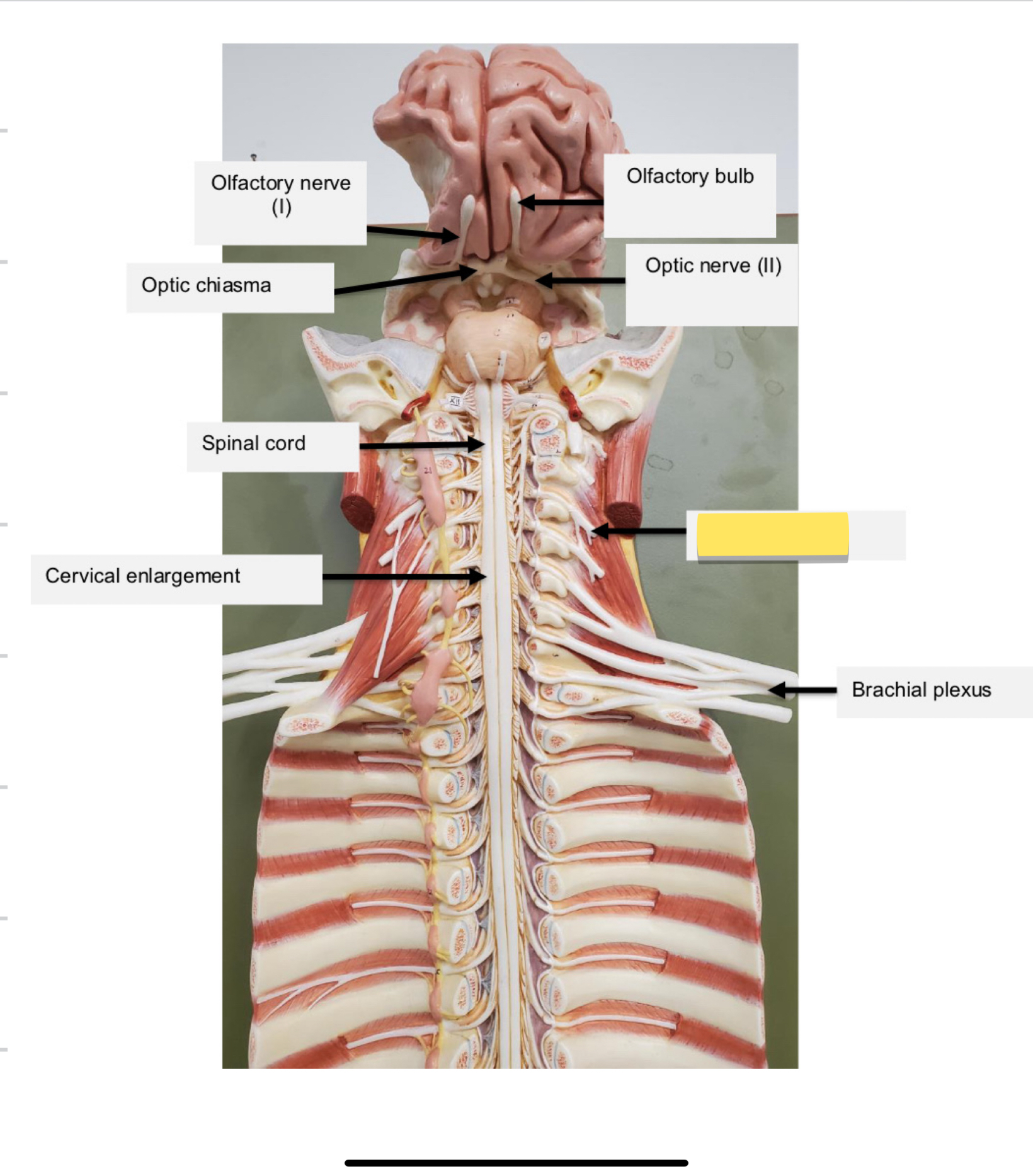 <p>Name this part</p>
