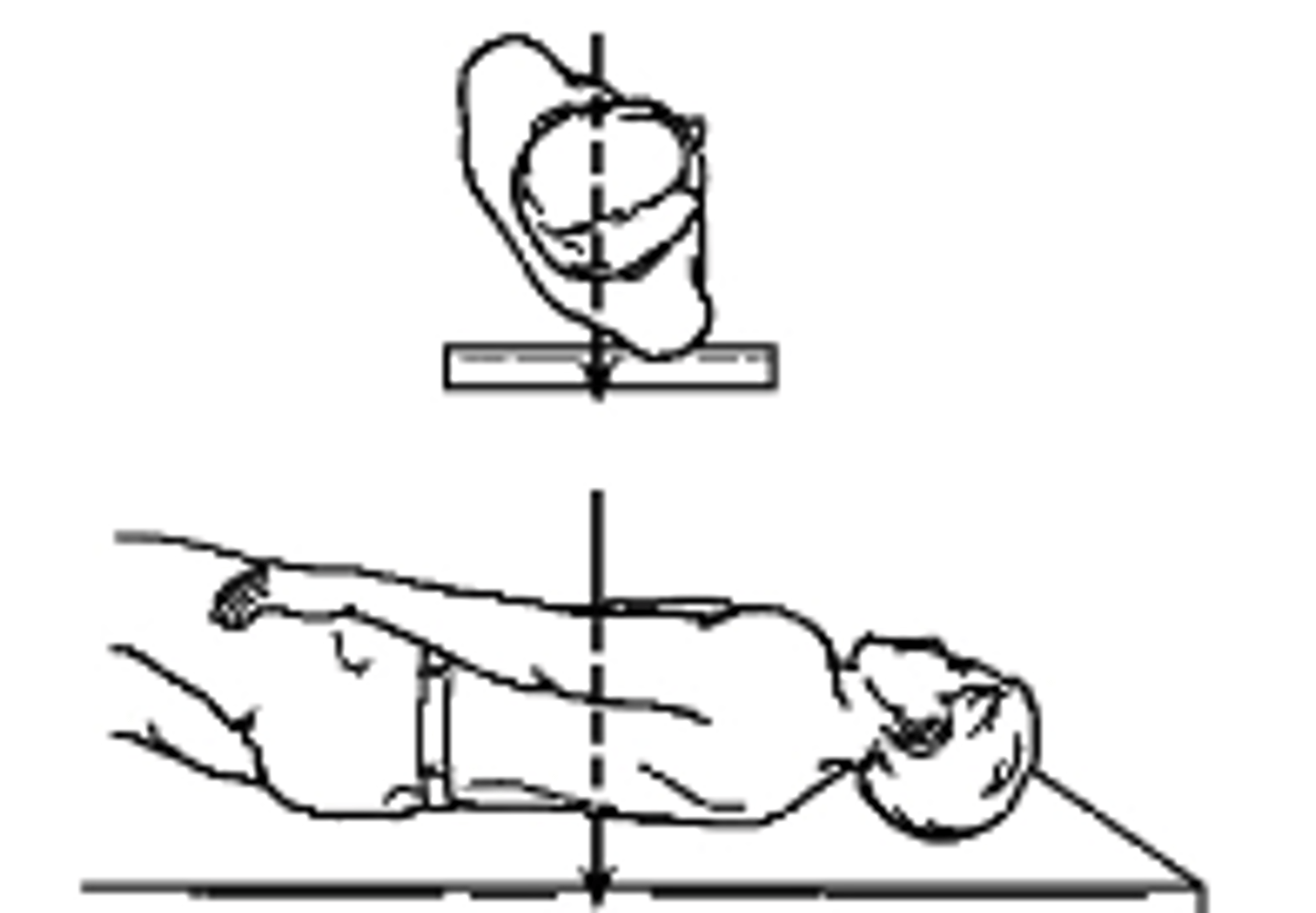 <p>what type of projection is this?</p><p>a. Left lateral</p><p>b. Right Lateral</p><p>c. Left AP Oblique</p><p>c. Right AP Oblique</p>