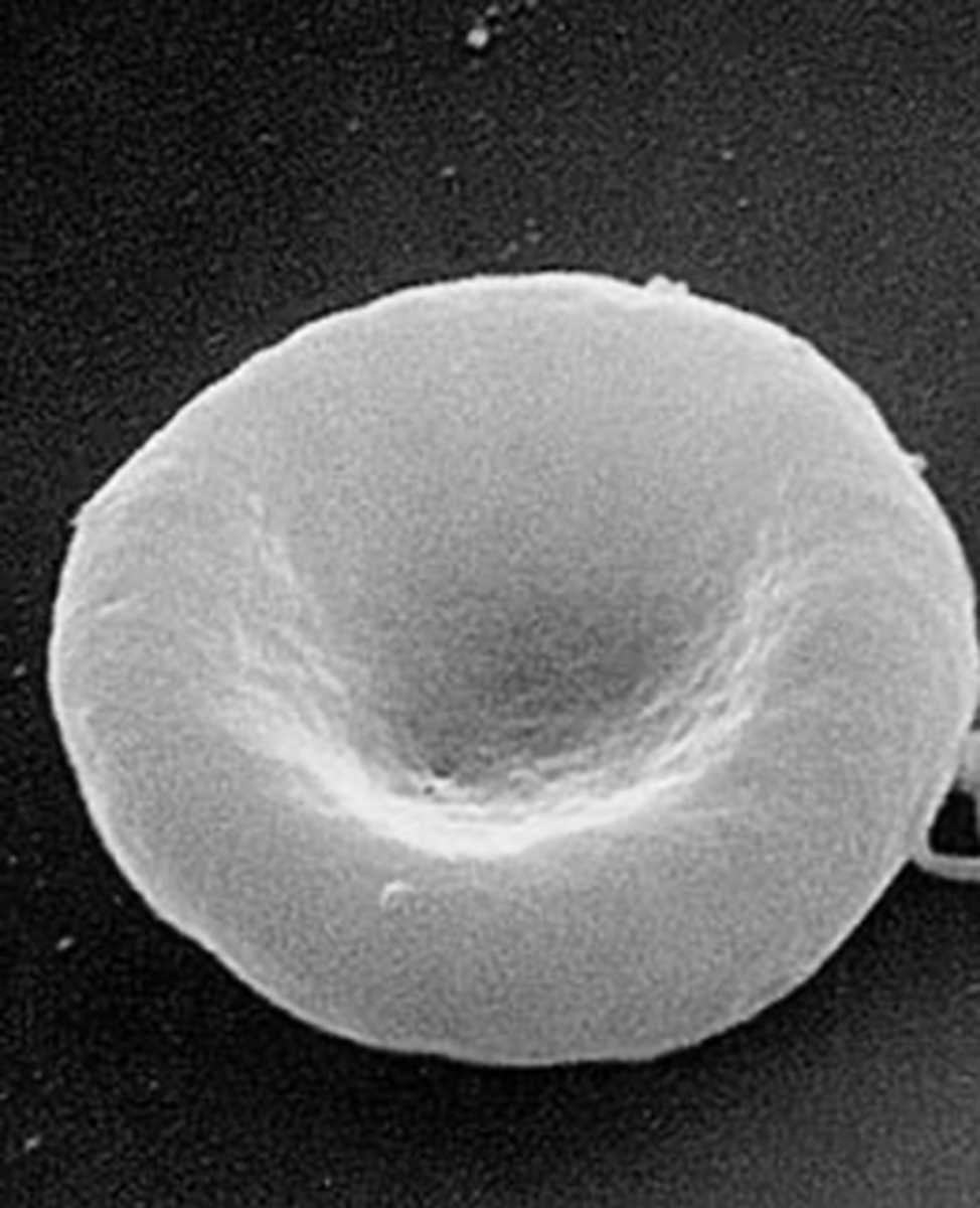 <p><span><span>RBC - concave discs that transport O2 in blood</span></span></p>