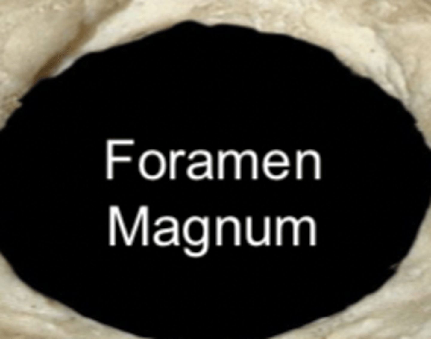 <p>the foramen magnum</p>