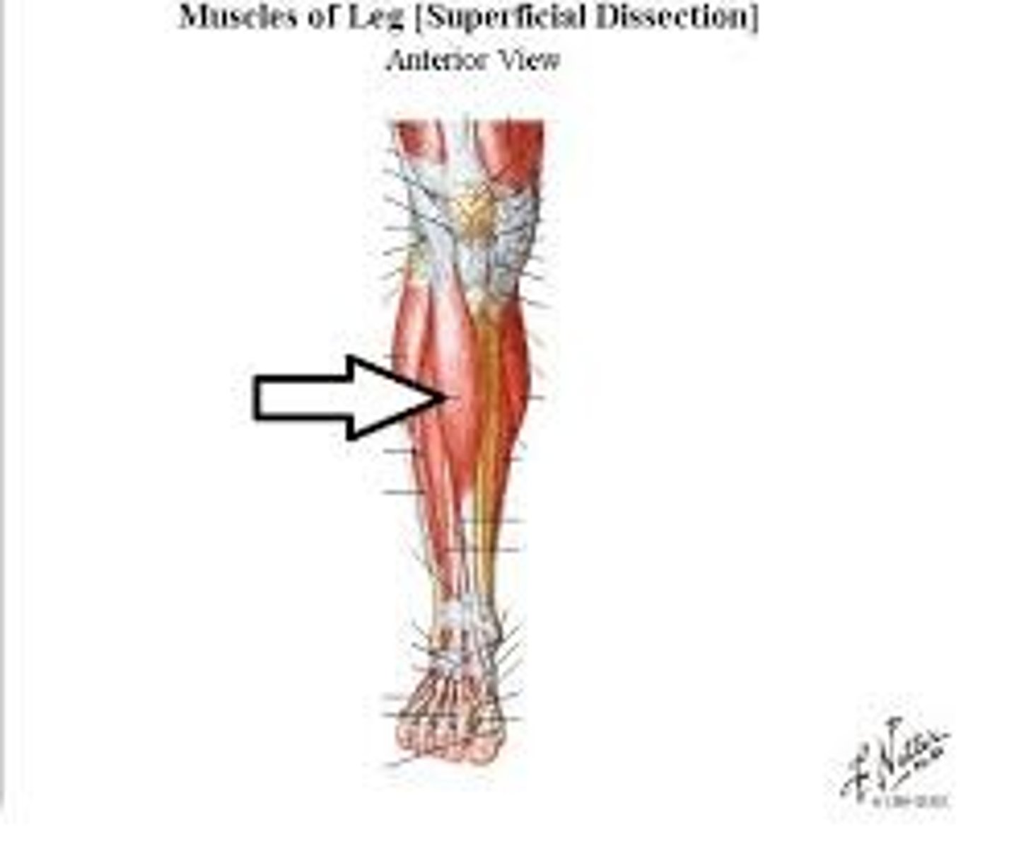 <p>anterior tibia, attaches to tendon on top of foot</p>
