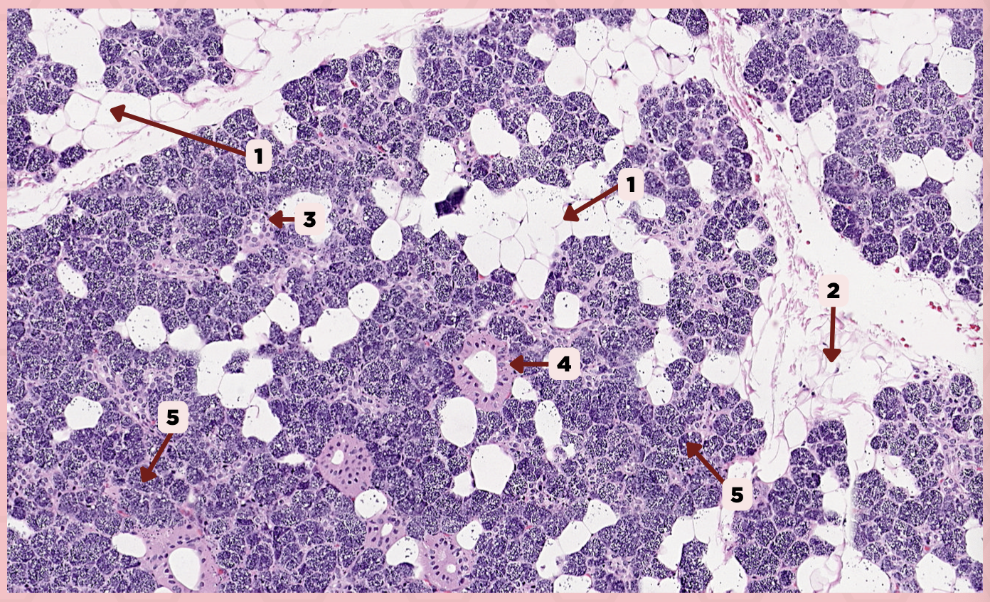 <p>This duct exhibits intense cytoplasmic eosinophilia and basal striations when seen in routine LM preparations.</p><p>A) Intercalated Ducts</p><p>B) Excretory Ducts</p><p>C) Striated Ducts</p>