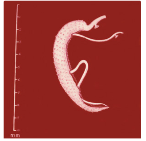 <p>Figure B: ______. The thin female resides in the gynecophoral canal of the thicker male. Note the tuberculate exterior of the male</p>