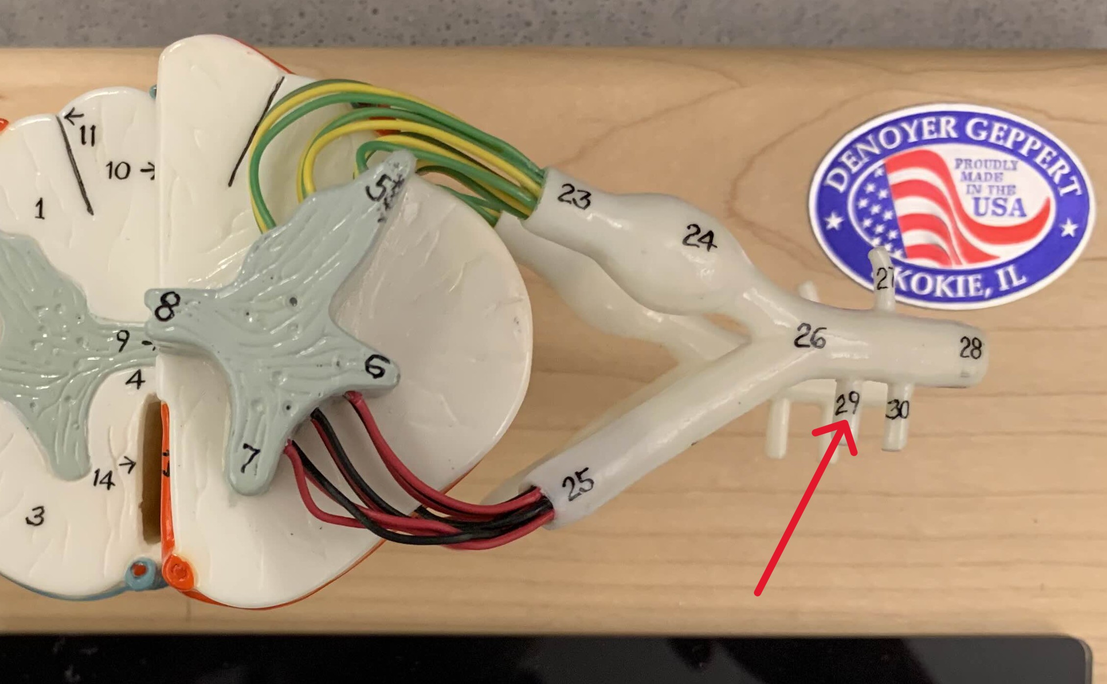 <p>Which ramus of the spinal cord is:</p><ul><li><p>Slightly medial to the white ramus</p></li><li><p>Attached to ventral ramus</p></li></ul><p></p>