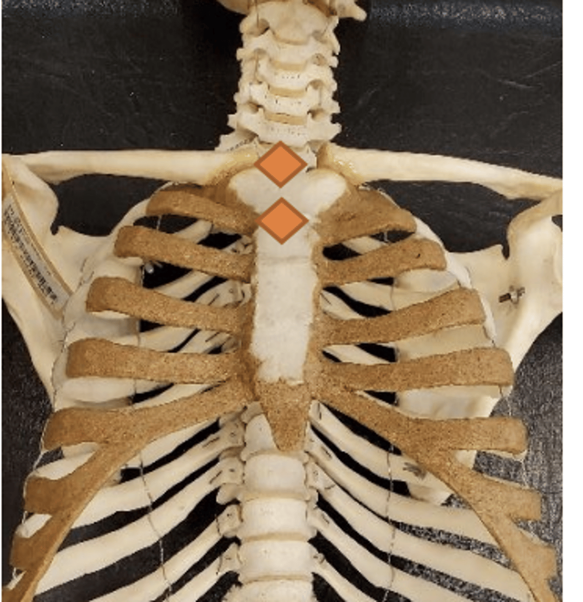 <p>Angle of Louis/sternal angle</p>