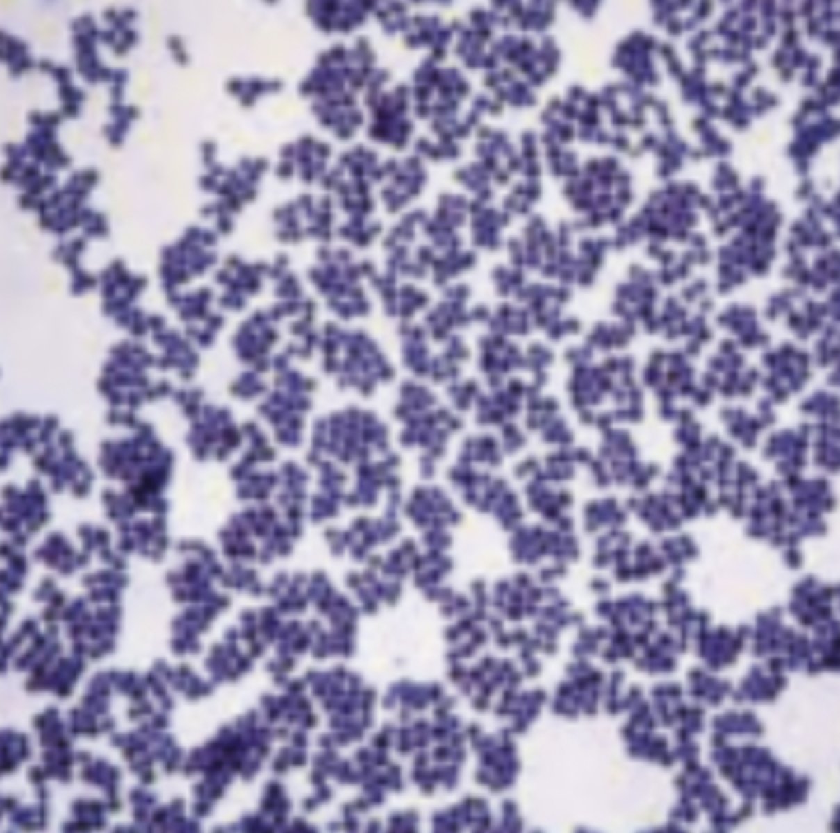 <p>Interpret the following gram stain reaction and describe the morphology</p>