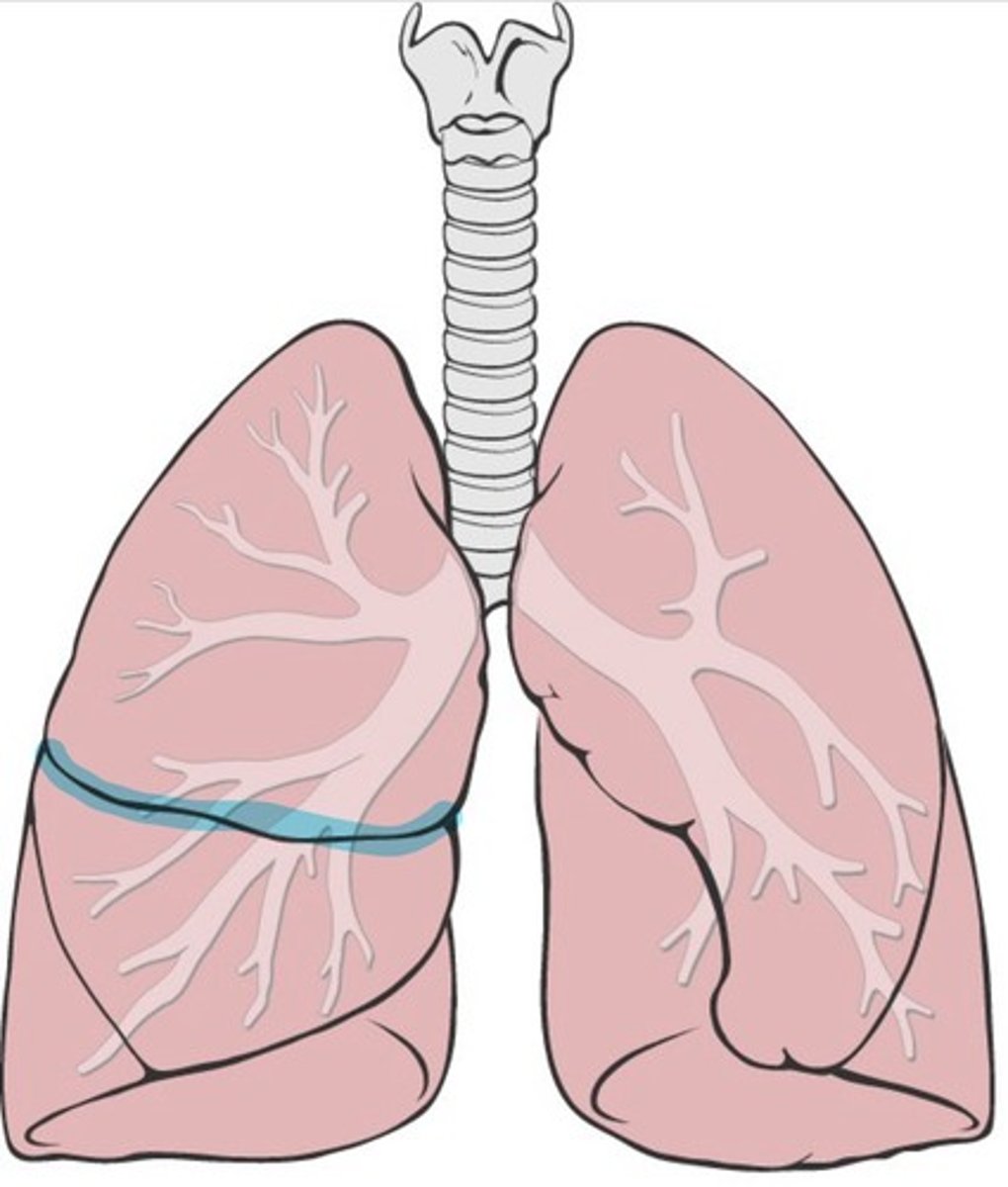 <p>First fissure that is more horizontal</p>