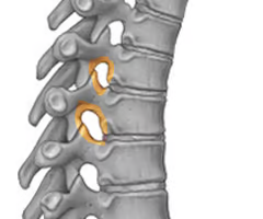 <p><strong>articulation between the superior and inferior</strong> articular processes of adjacent vertebral bodies</p><ul><li><p>diarthrotic</p></li><li><p>synovial</p></li><li><p>gliding</p></li></ul><p></p>