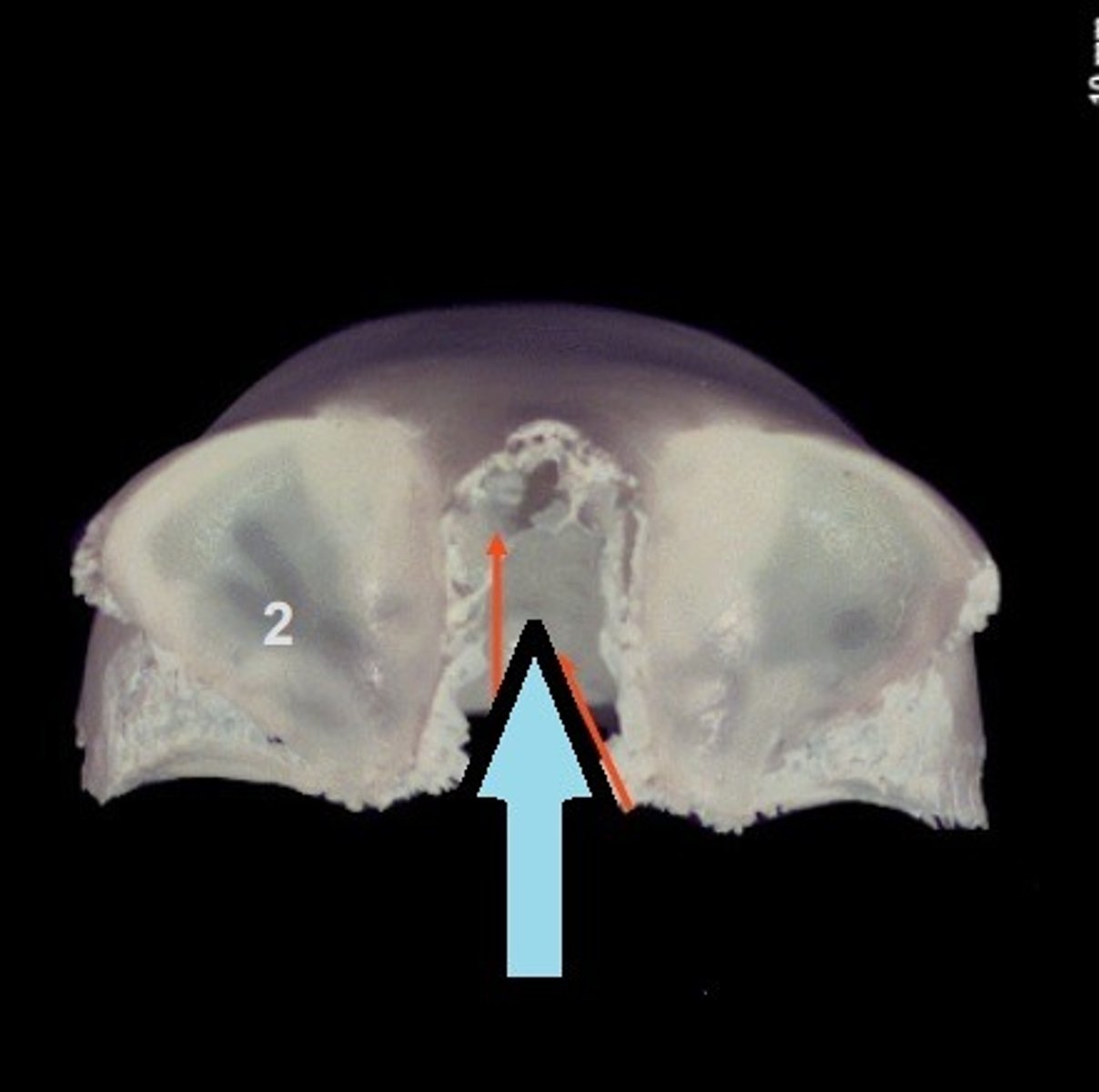 <p>The gap separating the two orbital plates of the frontal. The ethmoid bone fills this notch in the articulated cranium.</p>