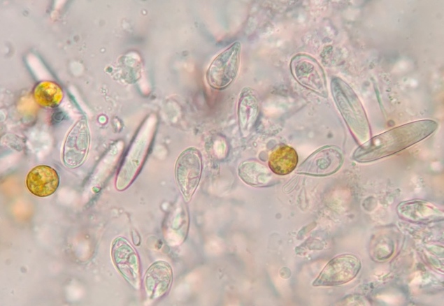 <p>Identify the parasite group</p>