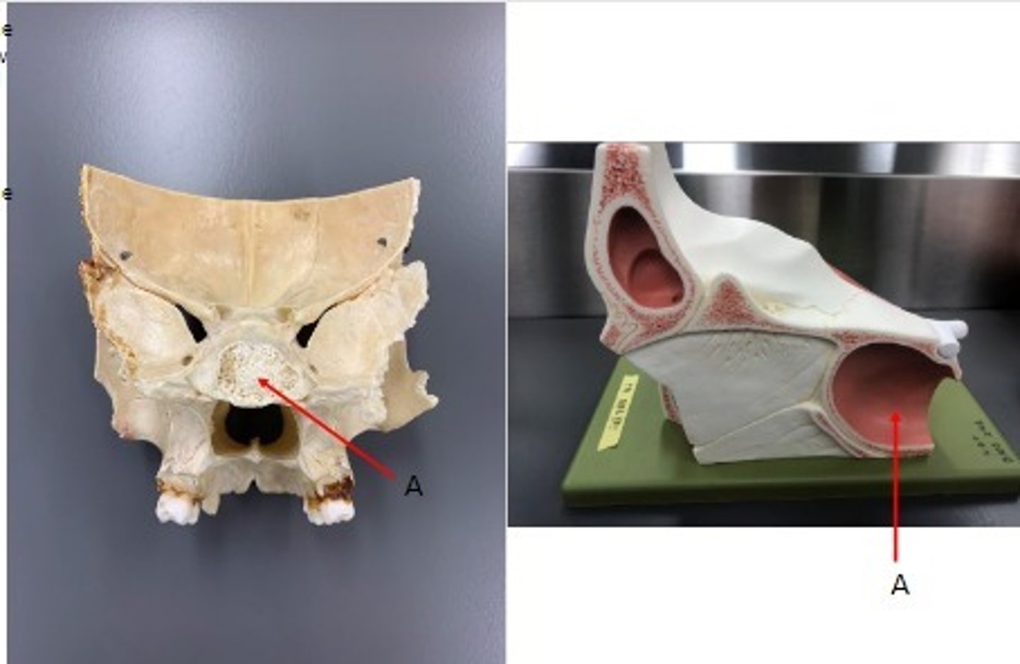 <p>What category of bone is it? What bone is it? Label the structures.</p>