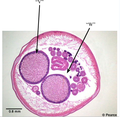 <p><span style="background-color: transparent; font-family: &quot;Times New Roman&quot;, serif;"><span>Identify structure “V”.&nbsp;Name the </span><u><span>space</span></u><span> at “W”. Name this animal.&nbsp;</span></span></p>