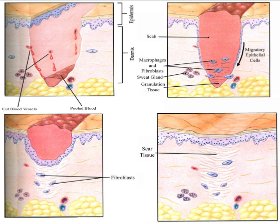 <ol><li><p>hemostaza (hamowanie wypływu krwi) - skurcz naczyń, agregacja płytek, krzepnięcie krwi</p></li><li><p>uprzątanie - napływ granulocytów i monocytów sprzątających martwe komórki</p></li><li><p>proliferacja - pączkowanie i rozrost młodych naczyń krwionośnych oraz pojawienie się fibroblastów i miofibroblastów</p></li><li><p>fibroplazja - produkcja kolagenu i substancji podstawowej, spadek liczby naczyń i komórek, remodeling, tworzenie blizny łącznotkankowej</p></li></ol>