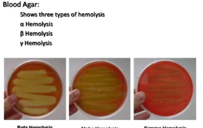 <img src="https://knowt-user-attachments.s3.amazonaws.com/8602ed2f-2f7d-4406-abad-5e0ce76685ed.png" data-width="25%" data-align="center"><p><strong>Alpha-haemolysis (α)</strong></p><ul><li><p><strong>Partial</strong> RBC breakdown → <strong>green zone</strong> on blood agar.</p></li><li><p>Caused by oxidation of haemoglobin</p></li></ul><p><strong>Beta-haemolysis (β)</strong></p><ul><li><p><strong>Complete</strong> RBC lysis → <strong>clear zone</strong> on blood agar.</p></li><li><p>Caused by haemolysins <strong>Streptolysin O and S</strong>.<strong><mark data-color="green" style="background-color: green; color: inherit;"> e.g. by </mark><em><mark data-color="green" style="background-color: green; color: inherit;">S. pyogenes</mark></em></strong></p></li></ul><p>Can also be classified by <strong>Lancefield groups</strong></p><p><strong>(immunological groups from A-O)</strong></p><p></p>