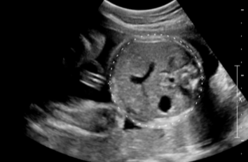 <p>what is being measured?</p>