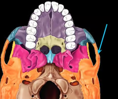 <p>Name this part of the temporal bone.</p>