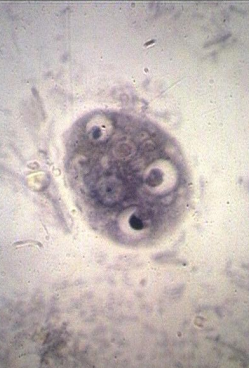Trofozoito de Entamoeba gingivalis