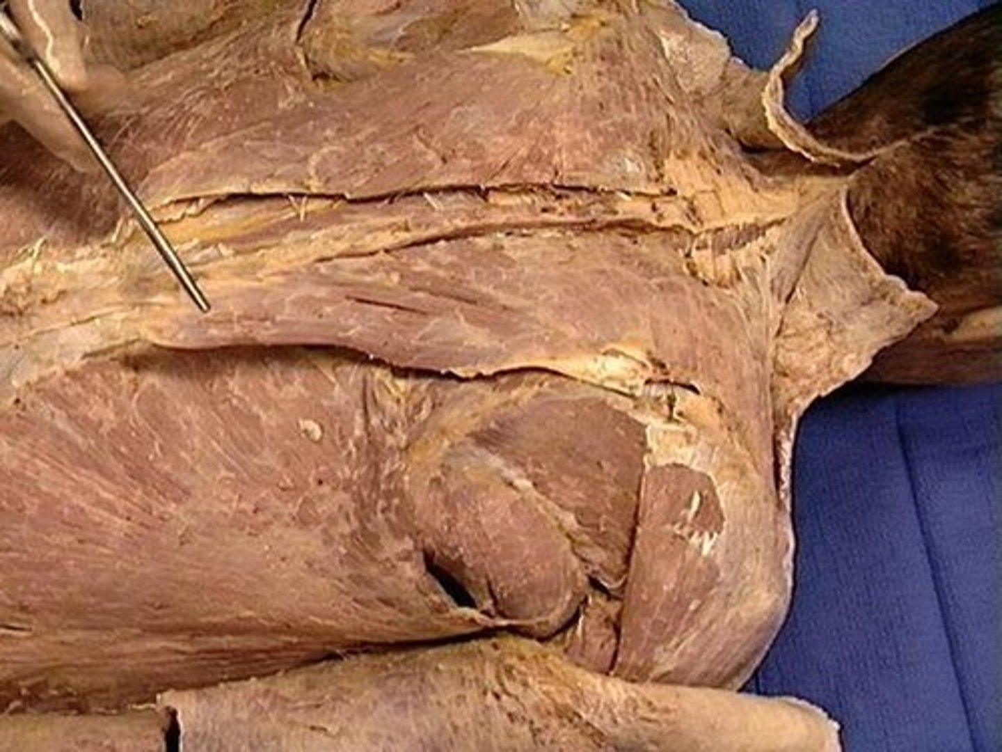 <p>Elevates, depresses, retracts, and rotates the scapula; rotates the arm</p>