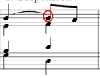 A note from the previous chord while all the others move to the following chord. Then is is resolved down by step on a weak beat of the new chord