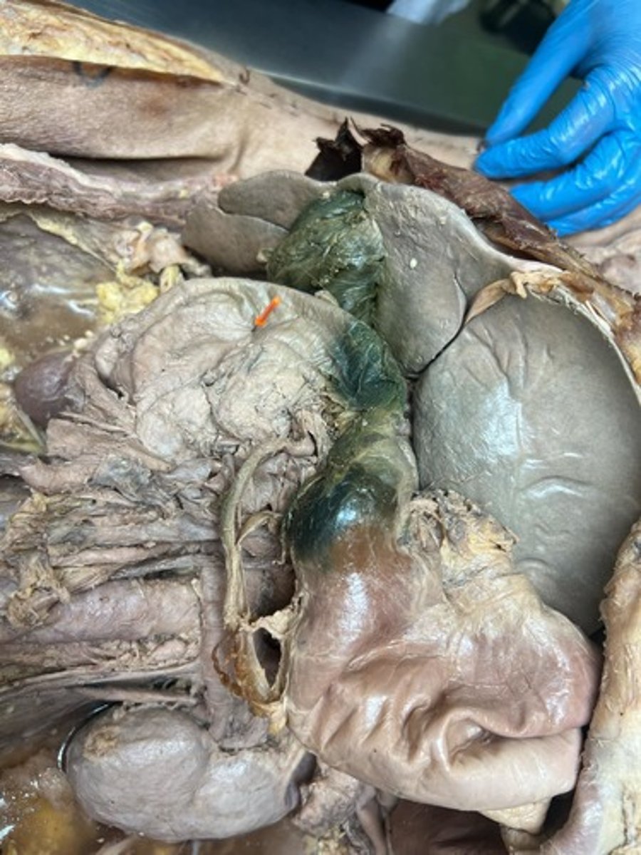 <p>descending part of duodenum</p>