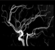 <p>What type of view are we observing the COW at?</p>