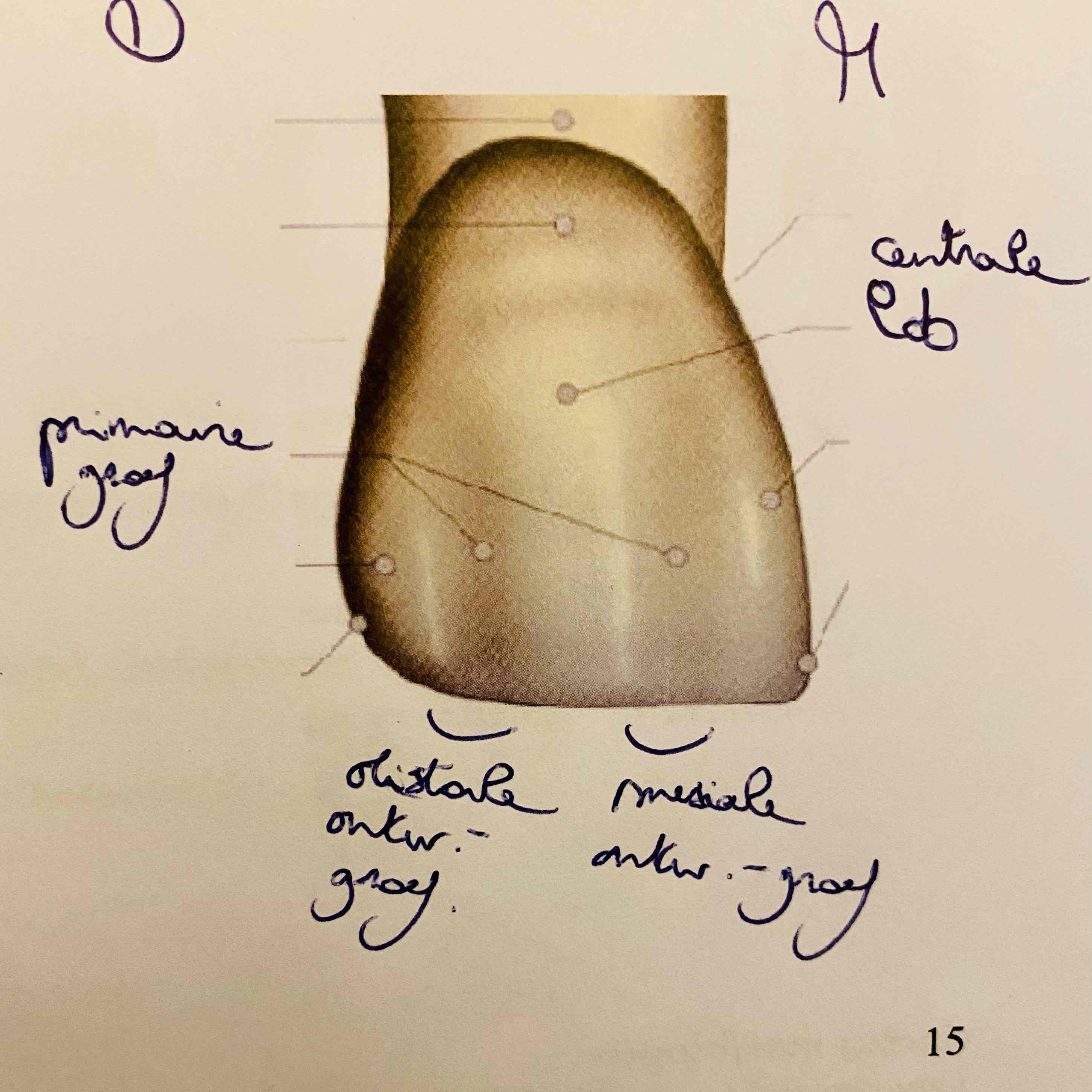 <p>Wat is een synoniem voor ontwikkelingsgroef?</p>