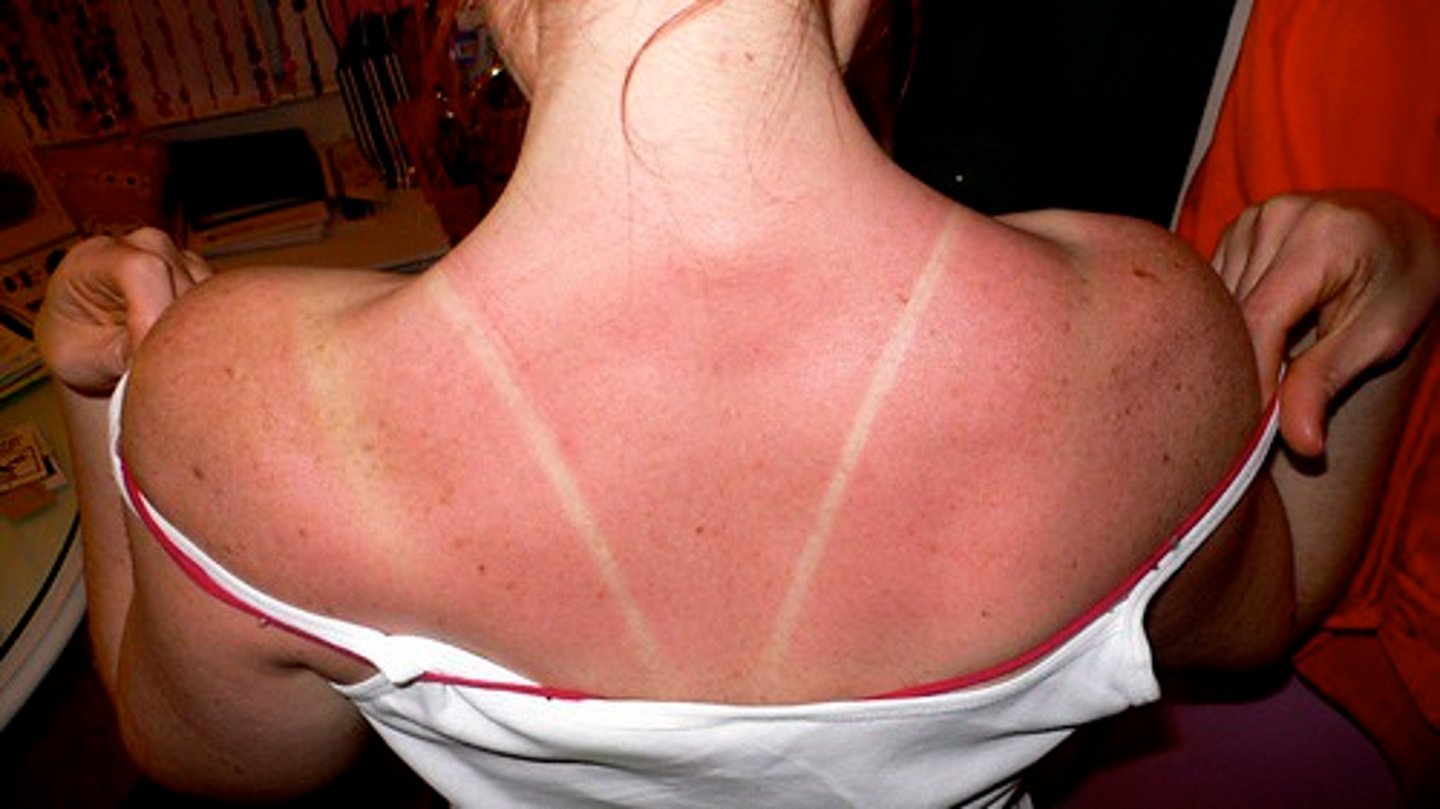 <p>I have got a sunstroke</p>