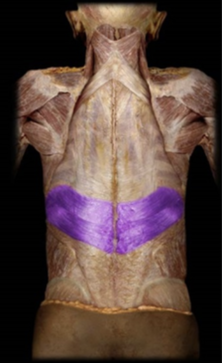 <p><em>table 3, deep to latissimus dorsi</em></p>