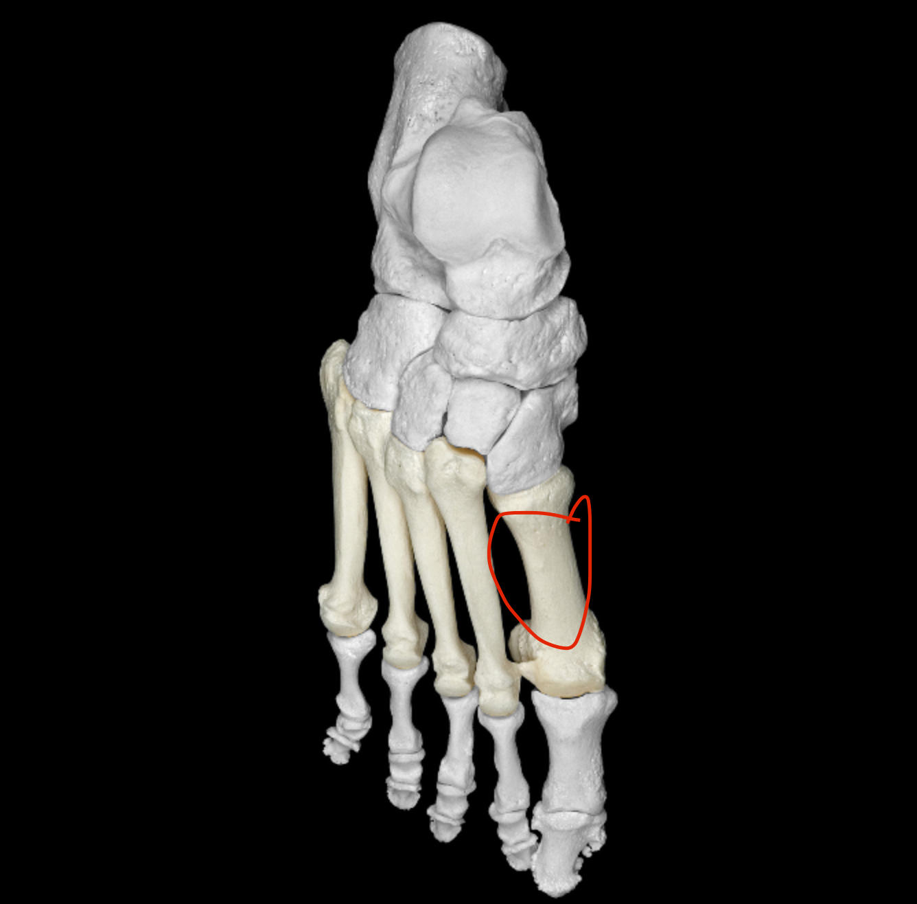 <p>main body of metatarsal</p>