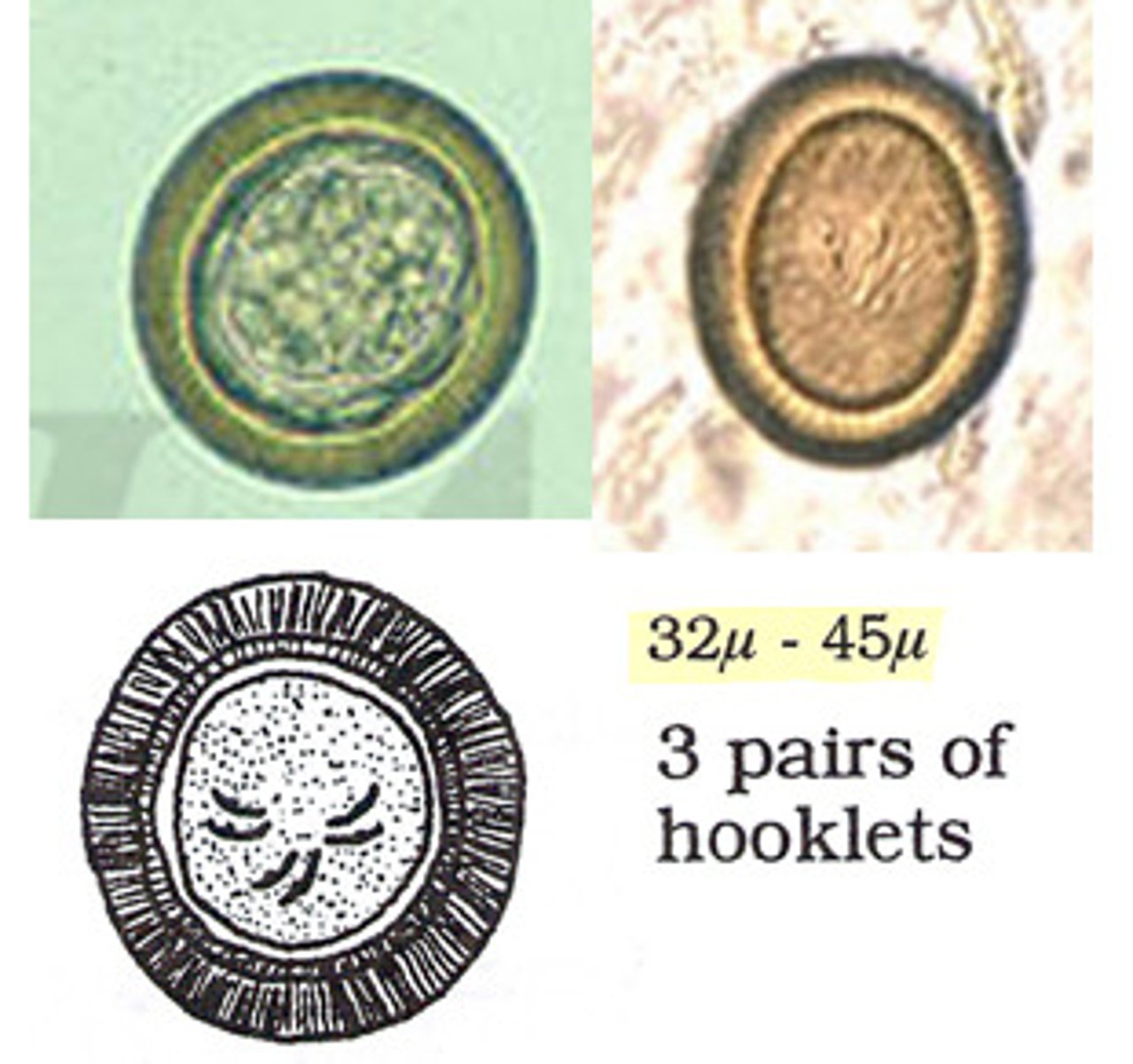 <p>These eggs were recovered from a stool specimen from a patient who repeatedly ate undercooked pork. Which tapeworm eggs are present?</p>